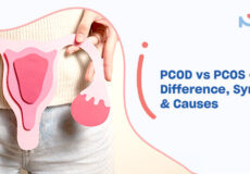 PCOD vs PCOS – Difference, Symptoms and Causes